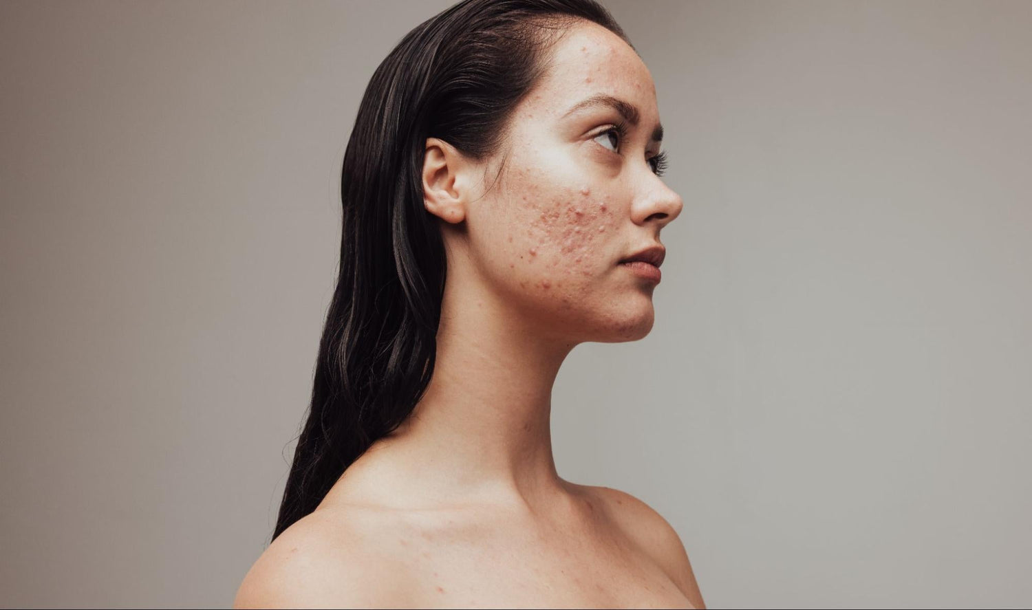 Best Skincare Products for Clogged Pores